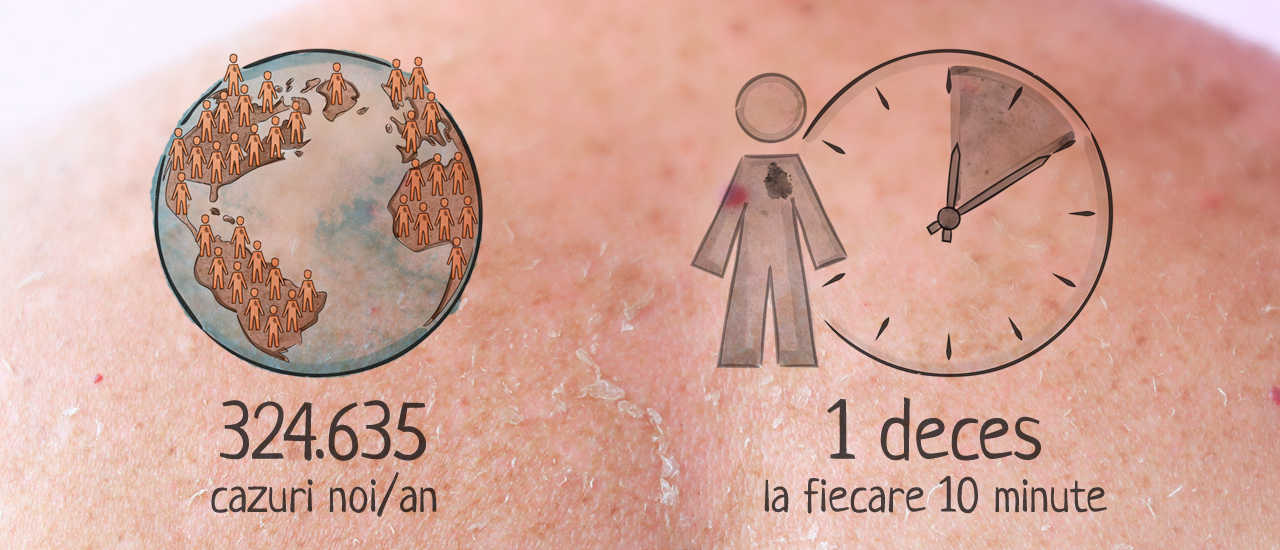 frecventa melanomului